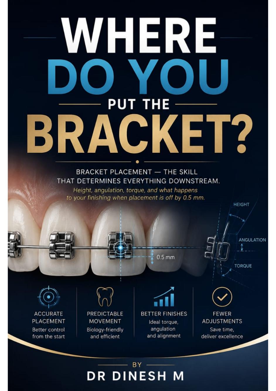 Where Do You Put the Bracket? — Volume 2 cover